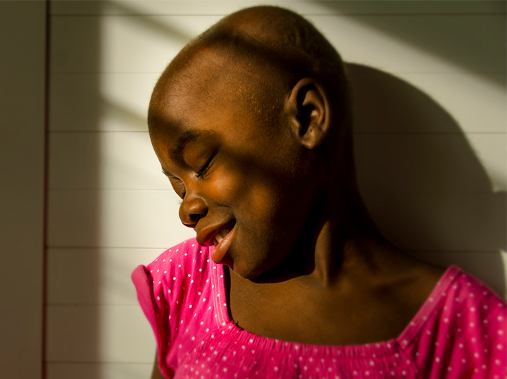 An oncology patient at St. Damien Pediatric Hospital, Haiti